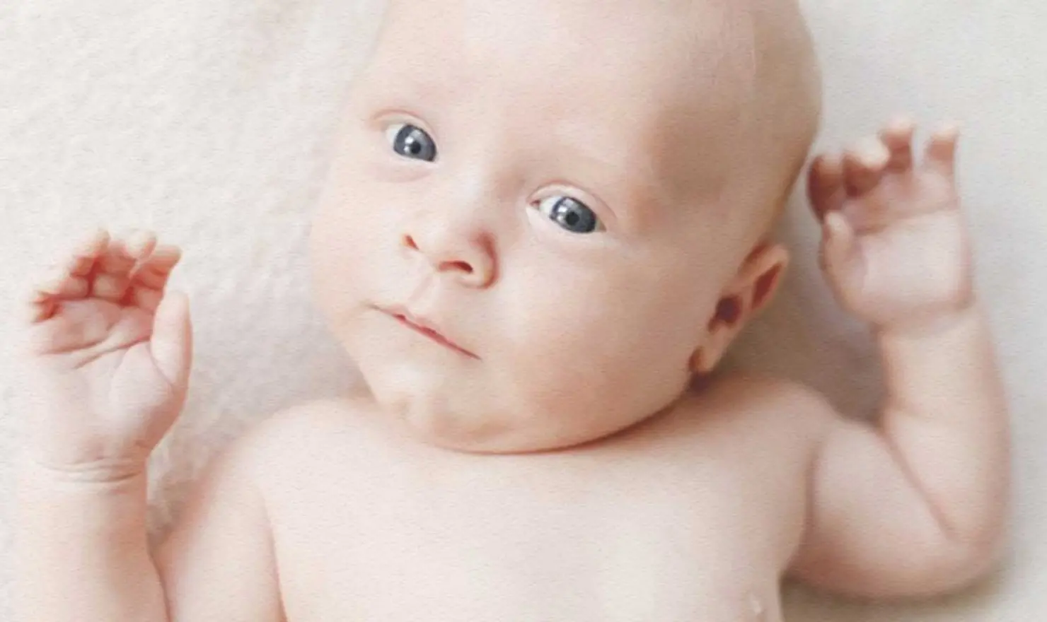 Tortikolis (Eğri Boyun Hastalığı)