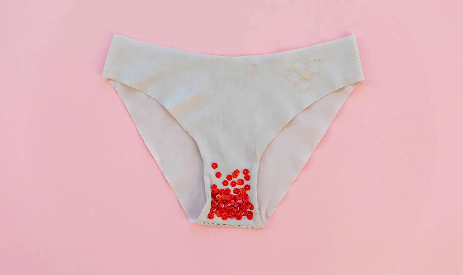 Vulvar Egzama (Rahim Egzaması)